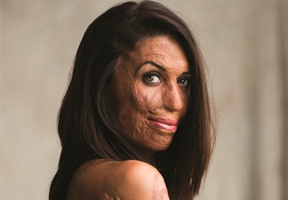 Turia Pitt - Uma história de amor e superação